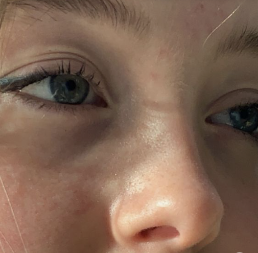 جراحی بینی فانتزی